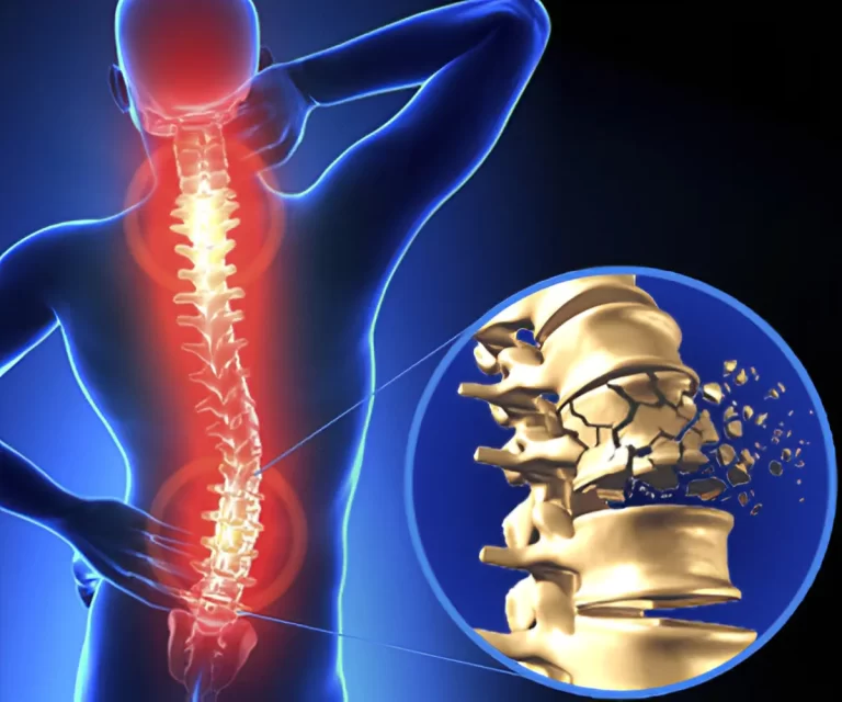 spinal-cord-injury-768x640